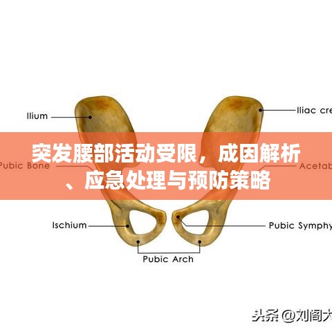 突發(fā)腰部活動(dòng)受限，成因解析、應(yīng)急處理與預(yù)防策略
