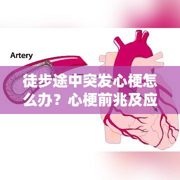 徒步途中突發(fā)心梗怎么辦？心梗前兆及應(yīng)對措施科普！